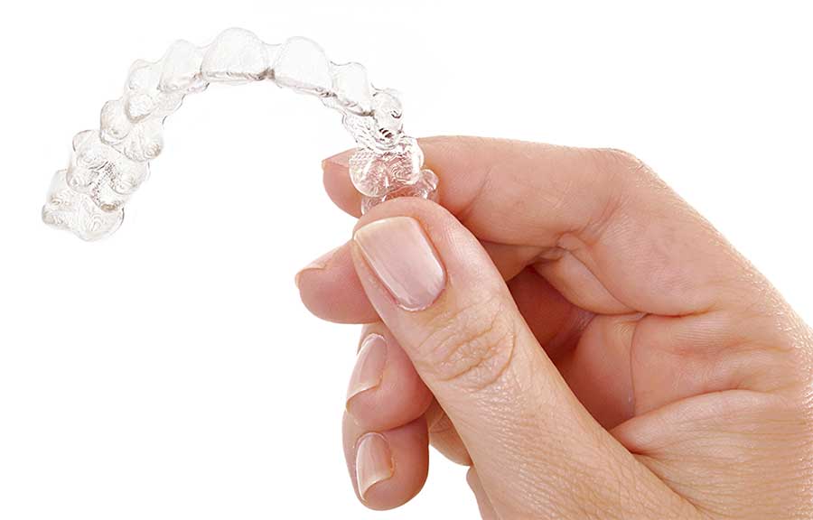 Invisalign Aligner